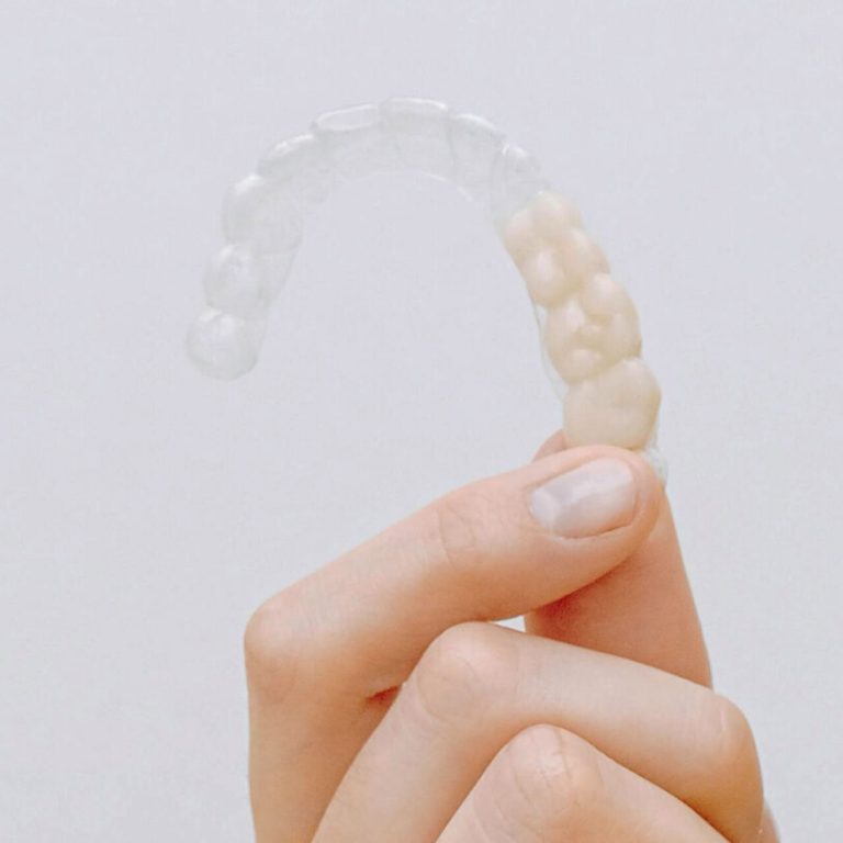 Clear-Aligners7