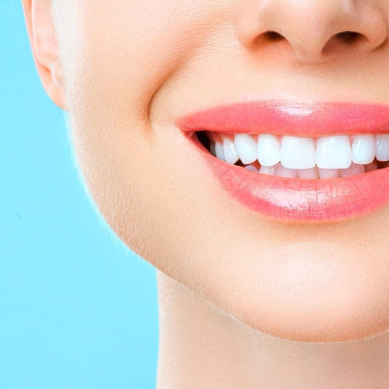 everything-you-need-to-know-about-professional-teeth-whitening